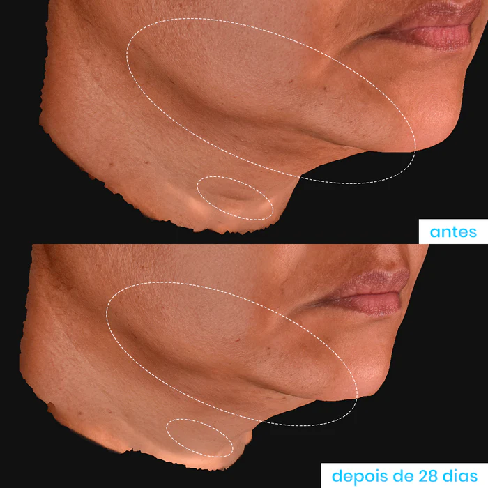 Super Pró-Colágeno 10% 30ml - Imagem 3